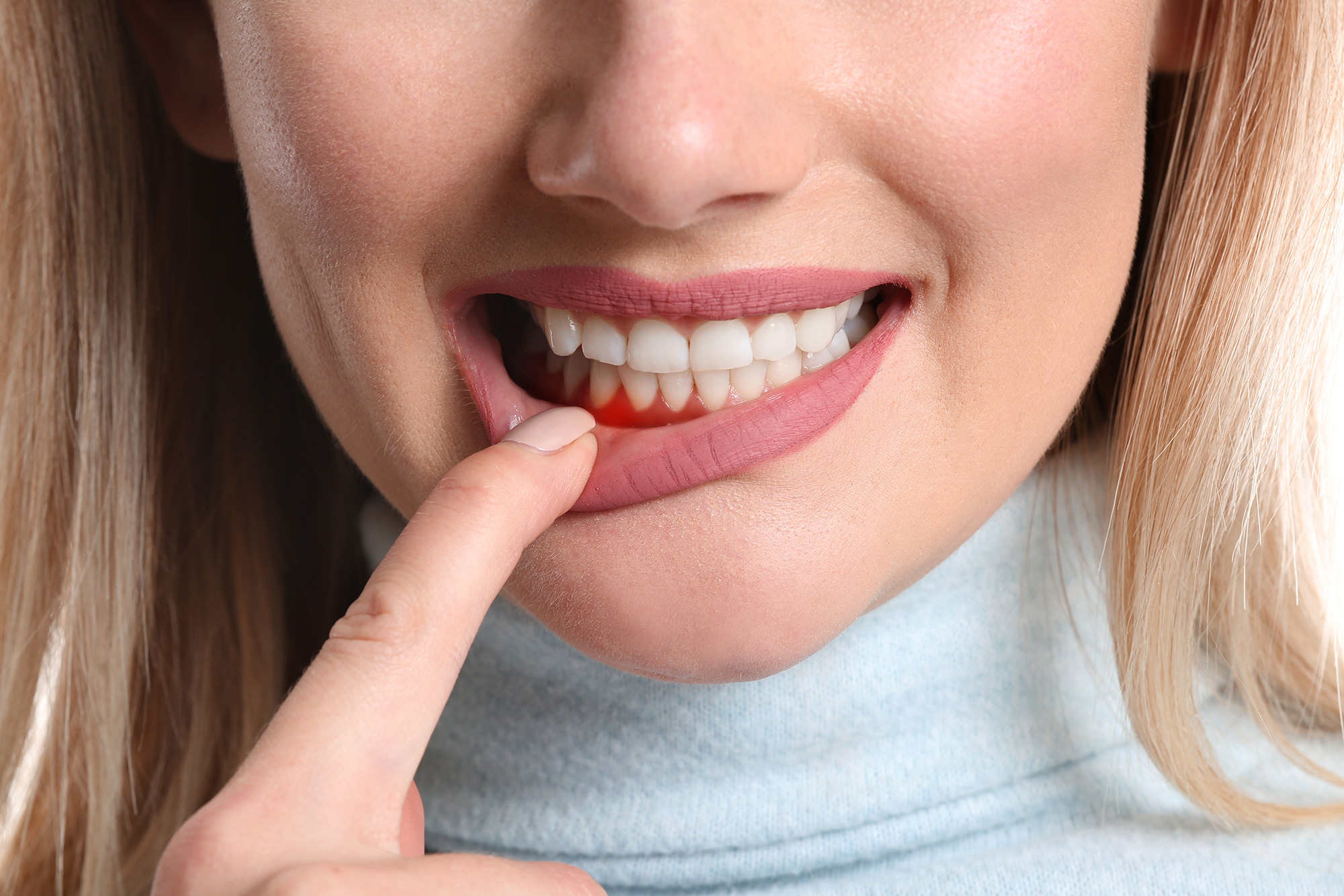 Bleeding Gums Bissell Periodontist Chester New Jersey