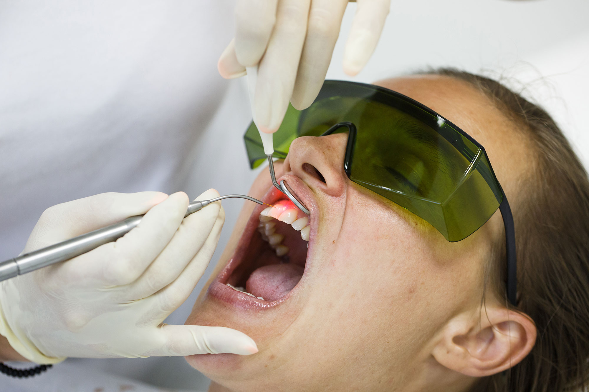 Laser Gum Surgery in Chester, NJ