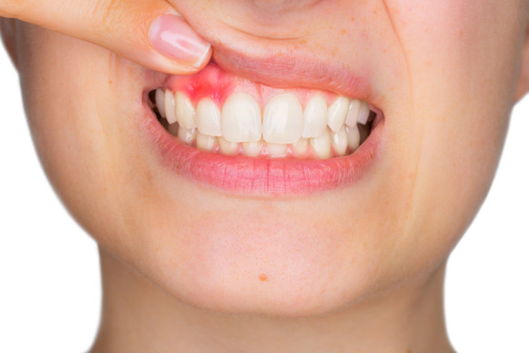osseous surgery in Chester, NJ?